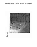 MARKER DETECTION IN X-RAY IMAGES diagram and image