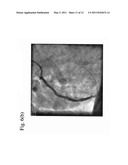 MARKER DETECTION IN X-RAY IMAGES diagram and image