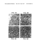 HUMAN IgM ANTIBODIES, AND DIAGNOSTIC AND THERAPEUTIC USES THEREOF PARTICULARLY IN THE CENTRAL NERVOUS SYSTEM diagram and image