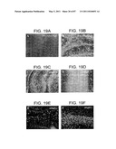 HUMAN IgM ANTIBODIES, AND DIAGNOSTIC AND THERAPEUTIC USES THEREOF PARTICULARLY IN THE CENTRAL NERVOUS SYSTEM diagram and image