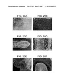 HUMAN IgM ANTIBODIES, AND DIAGNOSTIC AND THERAPEUTIC USES THEREOF PARTICULARLY IN THE CENTRAL NERVOUS SYSTEM diagram and image