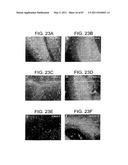 HUMAN IgM ANTIBODIES, AND DIAGNOSTIC AND THERAPEUTIC USES THEREOF PARTICULARLY IN THE CENTRAL NERVOUS SYSTEM diagram and image