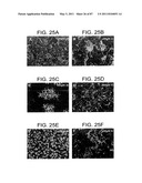 HUMAN IgM ANTIBODIES, AND DIAGNOSTIC AND THERAPEUTIC USES THEREOF PARTICULARLY IN THE CENTRAL NERVOUS SYSTEM diagram and image