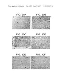 HUMAN IgM ANTIBODIES, AND DIAGNOSTIC AND THERAPEUTIC USES THEREOF PARTICULARLY IN THE CENTRAL NERVOUS SYSTEM diagram and image