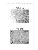 HUMAN IgM ANTIBODIES, AND DIAGNOSTIC AND THERAPEUTIC USES THEREOF PARTICULARLY IN THE CENTRAL NERVOUS SYSTEM diagram and image