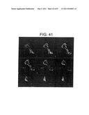 HUMAN IgM ANTIBODIES, AND DIAGNOSTIC AND THERAPEUTIC USES THEREOF PARTICULARLY IN THE CENTRAL NERVOUS SYSTEM diagram and image