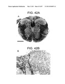 HUMAN IgM ANTIBODIES, AND DIAGNOSTIC AND THERAPEUTIC USES THEREOF PARTICULARLY IN THE CENTRAL NERVOUS SYSTEM diagram and image