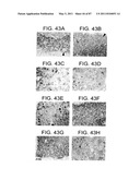 HUMAN IgM ANTIBODIES, AND DIAGNOSTIC AND THERAPEUTIC USES THEREOF PARTICULARLY IN THE CENTRAL NERVOUS SYSTEM diagram and image