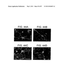 HUMAN IgM ANTIBODIES, AND DIAGNOSTIC AND THERAPEUTIC USES THEREOF PARTICULARLY IN THE CENTRAL NERVOUS SYSTEM diagram and image