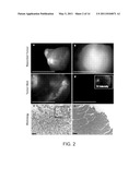 METHODS AND SYSTEMS FOR SPATIALLY IDENTIFYING ABNORMAL CELLS diagram and image