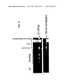 Methods and materials for treating autoimmune and/or complement mediated diseases and conditions diagram and image