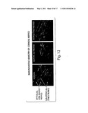 THERAPEUTIC COMPOSITIONS FOR TREATMENT OF OCULAR INFLAMMATORY DISORDERS diagram and image