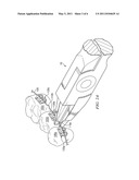 Apparatus and Method for Adjusting Orthodontic Wire diagram and image