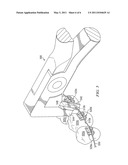 Apparatus and Method for Adjusting Orthodontic Wire diagram and image