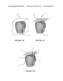 GENERATING A DYNAMIC THREE-DIMENSIONAL OCCLUSOGRAM diagram and image