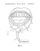 METHODS FOR EFFECTING ORAL TREATMENT OF TEETH OR GUMS diagram and image