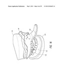 THERAPEUTIC TOOTH ABLATION diagram and image