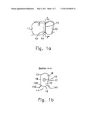 RESHAPABLE DEVICE FOR FIXATION AT A DENTAL SITE diagram and image