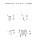 RESHAPABLE DEVICE FOR FIXATION AT A DENTAL SITE diagram and image