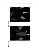 IMPLANT, IN PARTICULAR DENTAL IMPLANT diagram and image