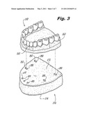 SYSTEM AND METHOD FOR ALIGNING TEETH diagram and image