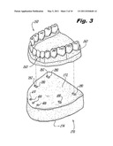 SYSTEM AND METHOD FOR ALIGNING TEETH diagram and image