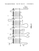 MUTANT SODIUM CHANNEL NAV 1.7 AND METHODS RELATED THERETO diagram and image