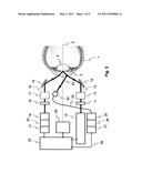 METHOD AND DEVICE FOR MEASURING DISSOLVED SUBSTANCES IN HUMAN OR ANIMAL INTRAOCULAR FLUID diagram and image