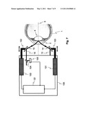 METHOD AND DEVICE FOR MEASURING DISSOLVED SUBSTANCES IN HUMAN OR ANIMAL INTRAOCULAR FLUID diagram and image