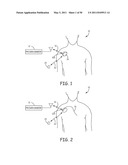 Method for Monitoring or Treating Nervous System Disorders diagram and image