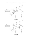 Method for Monitoring or Treating Nervous System Disorders diagram and image