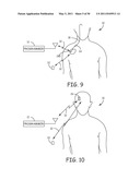 Method for Monitoring or Treating Nervous System Disorders diagram and image