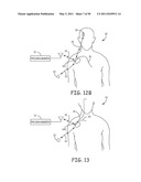 Method for Monitoring or Treating Nervous System Disorders diagram and image