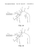 Method for Monitoring or Treating Nervous System Disorders diagram and image