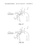 Method for Monitoring or Treating Nervous System Disorders diagram and image