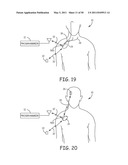 Method for Monitoring or Treating Nervous System Disorders diagram and image