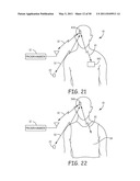 Method for Monitoring or Treating Nervous System Disorders diagram and image