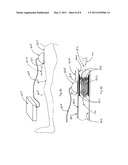 Ultrasound-enhanced Stenosis therapy diagram and image