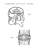 Treating back pain by re-establishing the exchange of nutrient & waste diagram and image