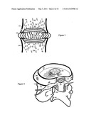 Treating back pain by re-establishing the exchange of nutrient & waste diagram and image