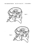 Treating back pain by re-establishing the exchange of nutrient & waste diagram and image