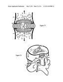 Treating back pain by re-establishing the exchange of nutrient & waste diagram and image