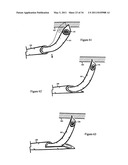 Treating back pain by re-establishing the exchange of nutrient & waste diagram and image