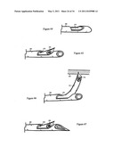 Treating back pain by re-establishing the exchange of nutrient & waste diagram and image