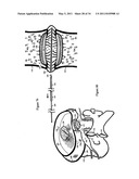 Treating back pain by re-establishing the exchange of nutrient & waste diagram and image