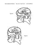 Treating back pain by re-establishing the exchange of nutrient & waste diagram and image