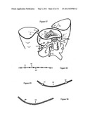 Treating back pain by re-establishing the exchange of nutrient & waste diagram and image