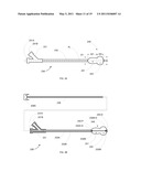 ANTERIOR INFLATION BALLOON diagram and image