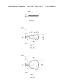 ANTERIOR INFLATION BALLOON diagram and image