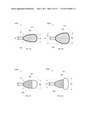 ANTERIOR INFLATION BALLOON diagram and image